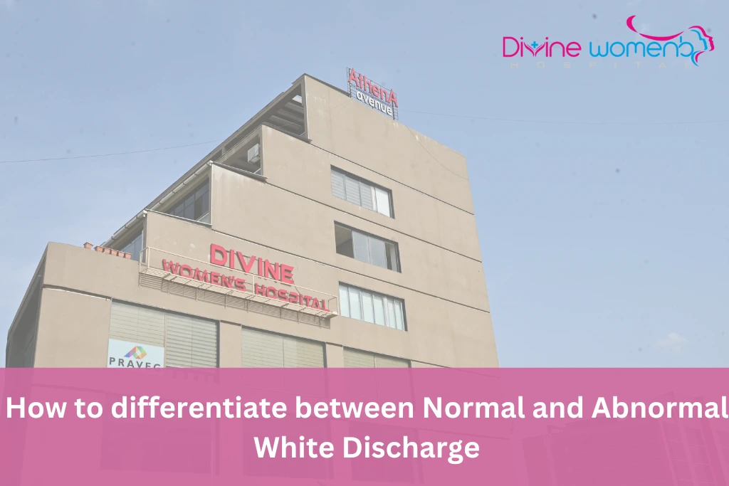 Normal and Abnormal White Discharge